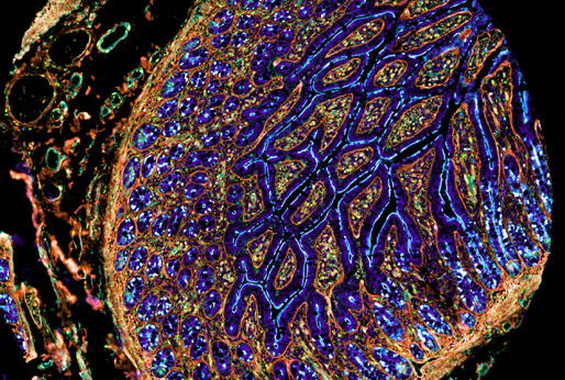 Microscopy and Computer Vision