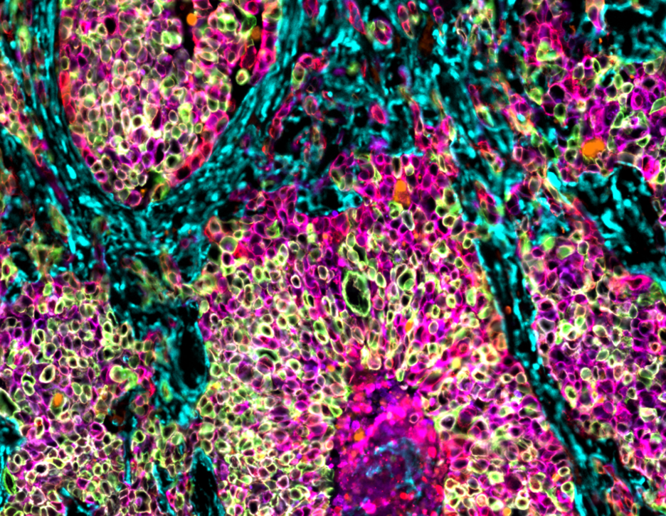 thumbnail for publication: AKT and EZH2 inhibitors kill TNBCs by hijacking mechanisms of involution