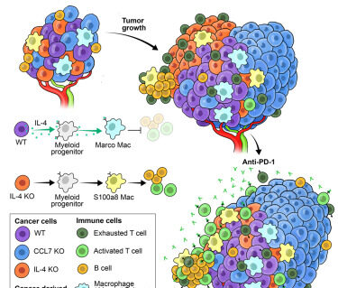 thumbnail for publication: Ovarian cancer-derived IL-4 promotes immunotherapy resistance